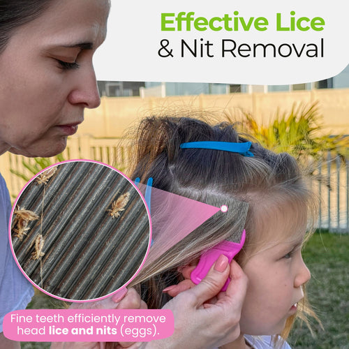 lice nit removal